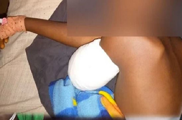 Manifestations de soutien à Ousmane Sonko : l’élève amputé du bras est sorti de l’hôpital