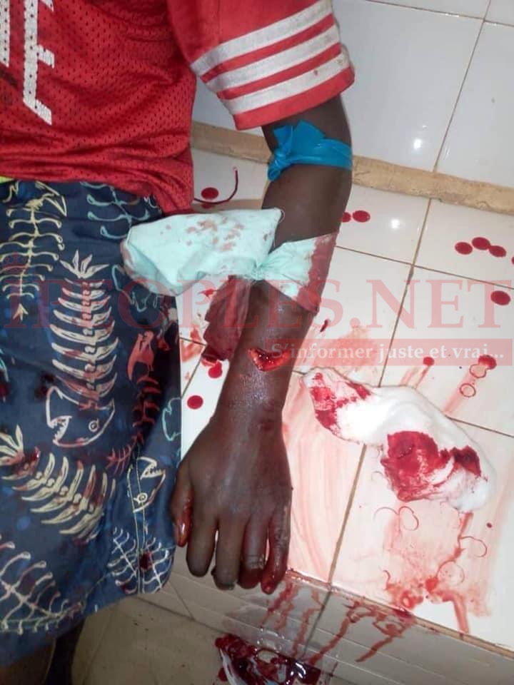 Contre l’arrestation de Ousmane Sonko: Un mort et deux blessés graves à Bignona