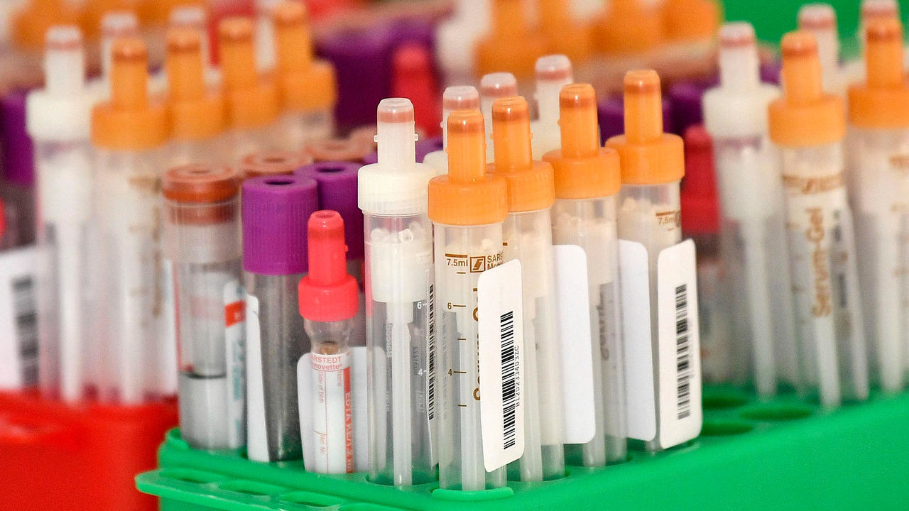 L'Agence européenne des médicaments publie des recommandations sur le traitement du Covid-19