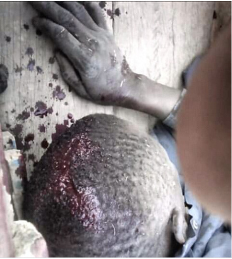 Affrontements à Ndingler : Des blessés entre paysans et sécurité de Babacar Ngom enregistrés