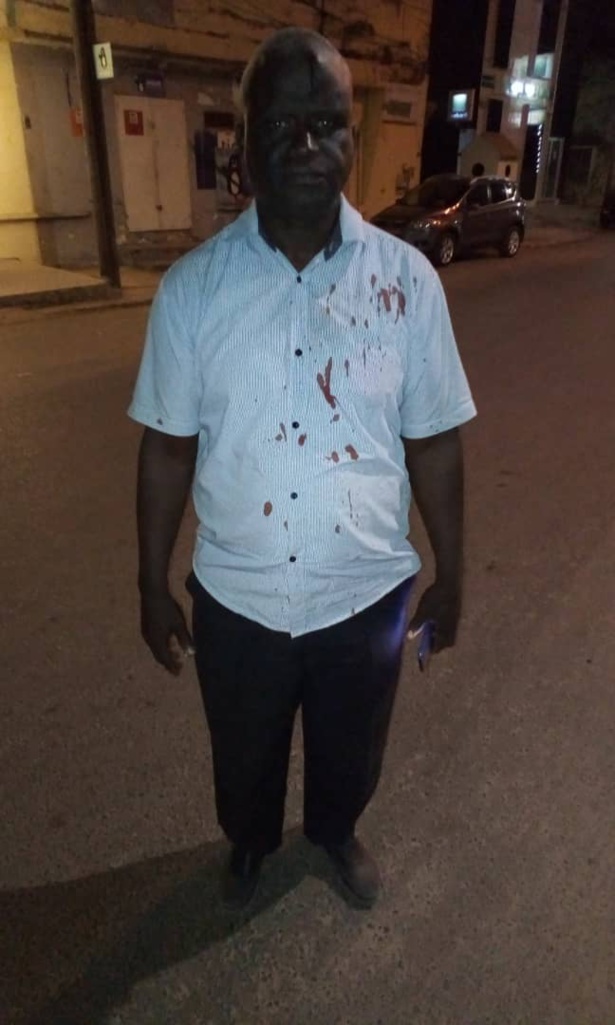 Agression d'Ousmane Coly: Abdou Sané de Pastef /Ziguinchor accuse le camp de Baldé