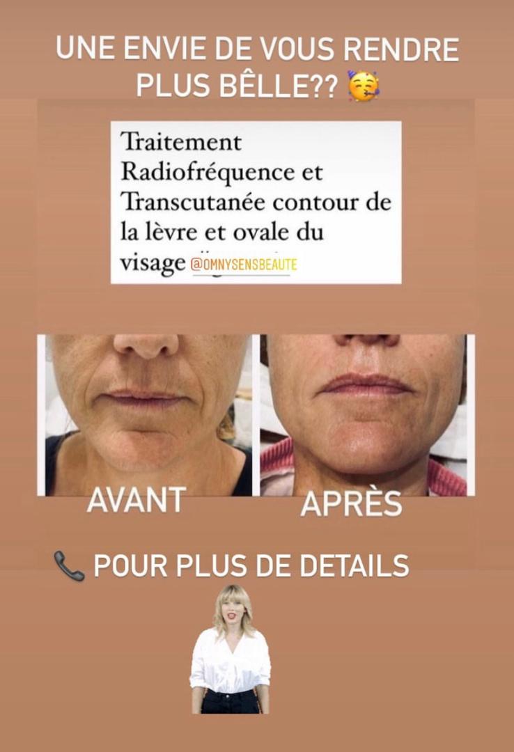 Une beauté sure et naturelle Omnysens Beauté et Santé assure votre satisfaction TEL 33 823 39 85.
