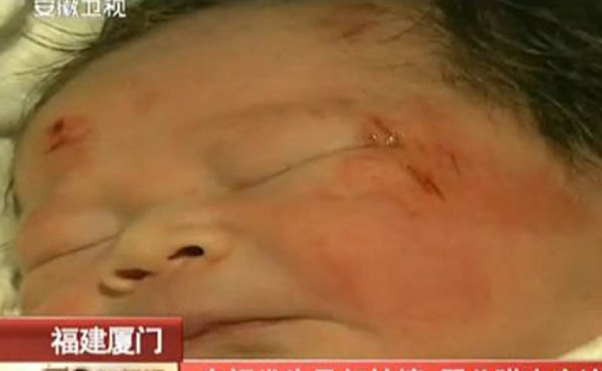 CHINE -  un bébé expulsé du ventre de sa mère lors d'un accident de la route ?