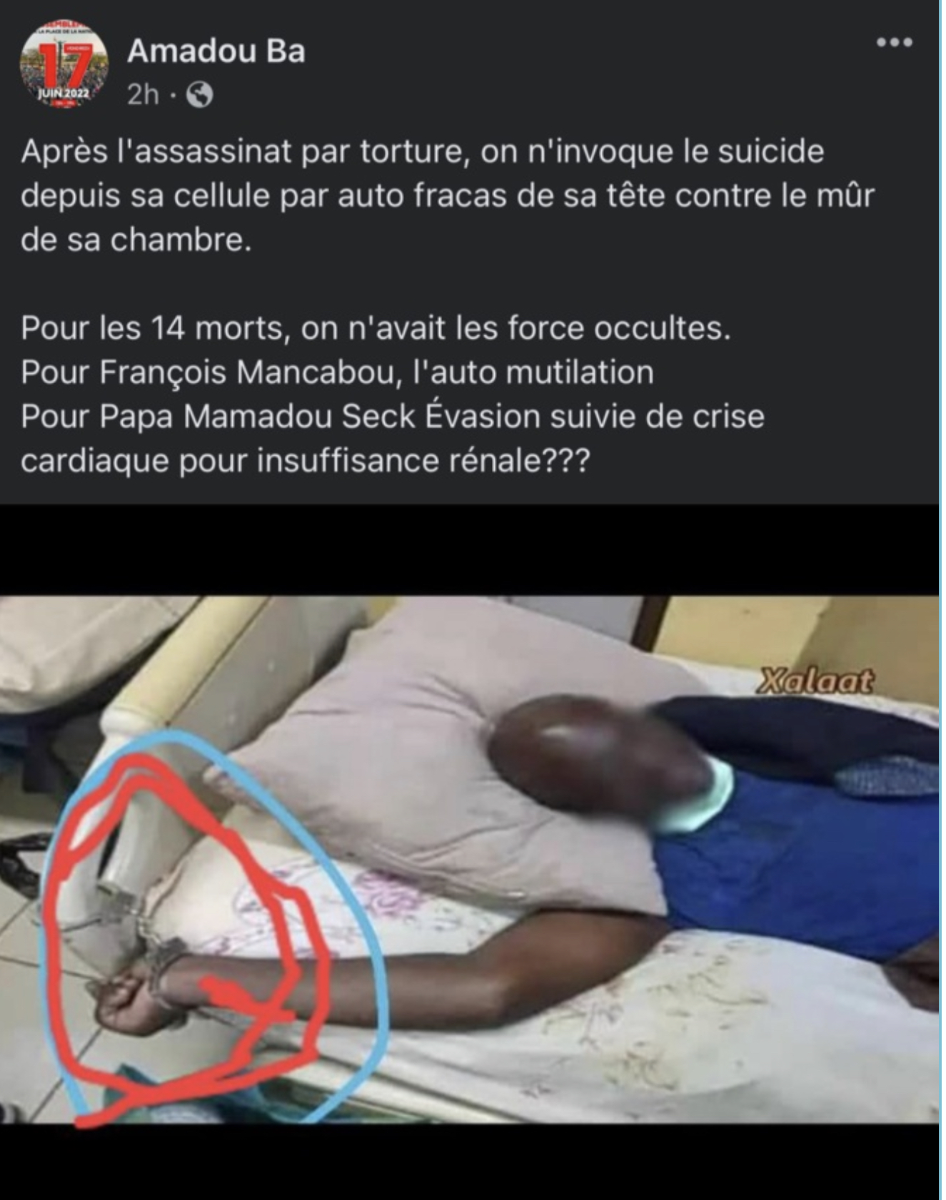 Cette photo publiée sur les réseaux sociaux n'est pas celle de François Mancabou : C'est celle d'un détenu anglophone décédé en 2020 au Cameroun