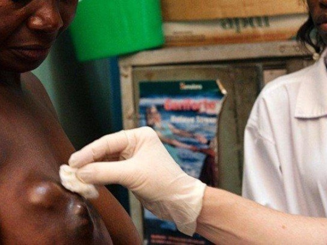 Dépistage au niveau de la région de Diourbel : 19 femmes atteintes de cancer du sein