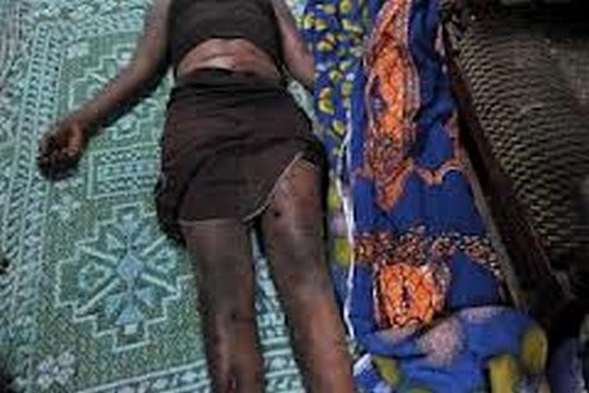Vélingara : une fille de 16 ans se suicide suite à une grossesse