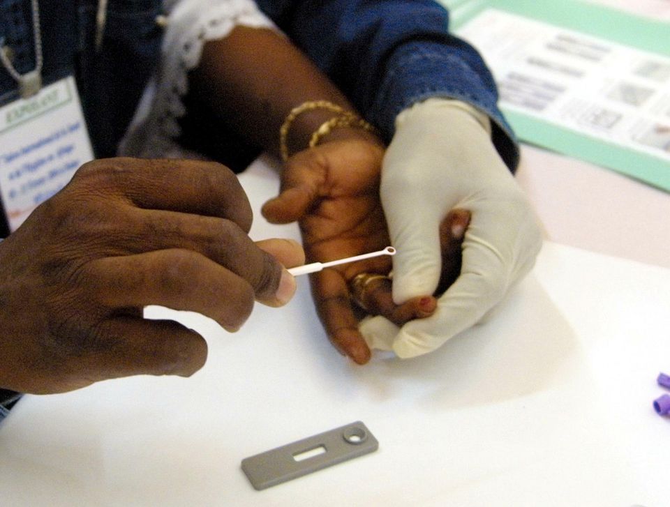 Un médicament contre l’alcoolisme pourrait éliminer le virus du Sida