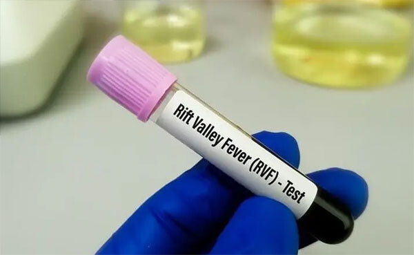 Mpox et Fièvre de la Vallée du Rift : Thiès enregistre son premier cas , 302 cas confirmés au Sénégal Mpox et Fièvre de la Vallée du Rift : Thiès enregistre son premier cas , 302 cas confirmés au Sénégal