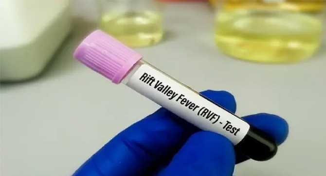 FVR et Mpox : 5 nouveaux cas et 1 décès : La situation sanitaire sous surveillance au Sénégal, le ministère renforce l'alerte sanitaire FVR et Mpox : 5 nouveaux cas et 1 décès : La situation sanitaire sous surveillance au Sénégal, le ministère renforce l'alerte sanitaire