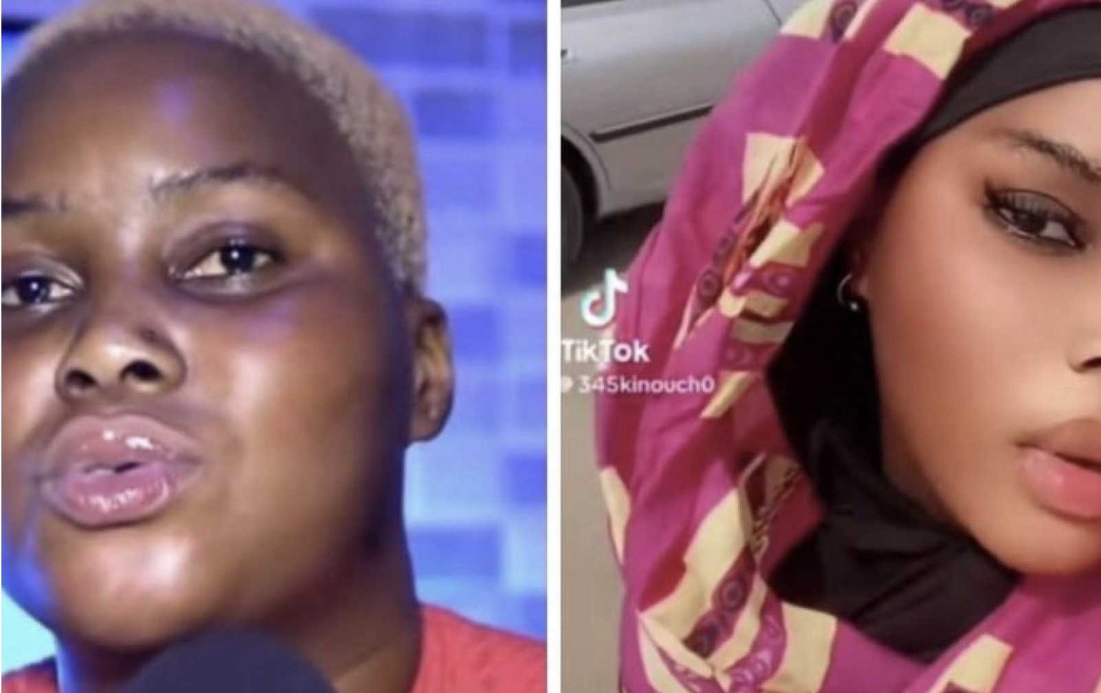 Décès de la danseuse Kinoush : quand le drame ravive le débat sur les produits grossissants