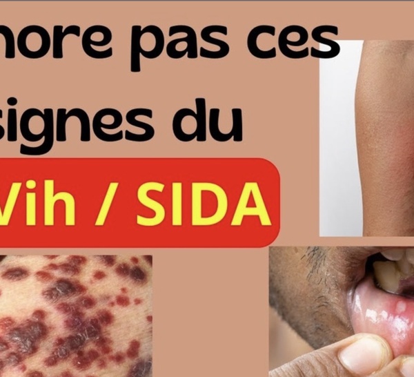 Contact avec une personne vivant avec le VIH : Que faire concrètement et sans paniquer ?