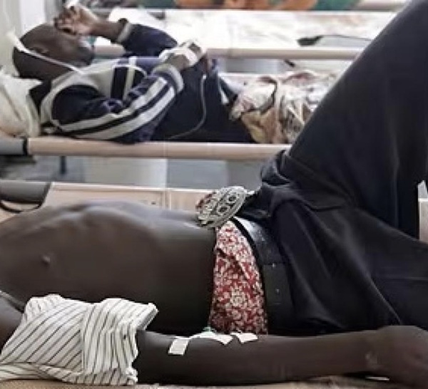 800 cas et 24 décès: Les chiffres préoccupants de la tuberculose à Kaolack