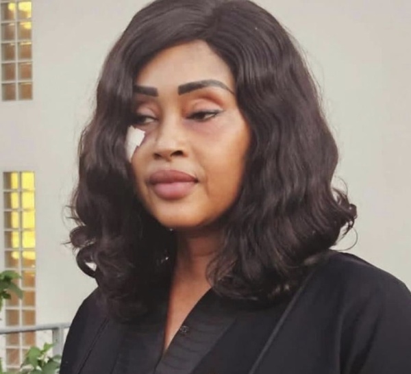 Blessée en mission, la députée Maimouna Bousso envoie un message à Ousmane Sonko et Bassirou Diomaye Faye