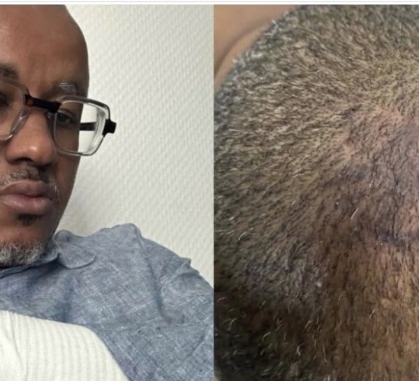 Tribunal de Pikine-Guédiawaye : Oumar Sow porte plainte avec constitution de partie civile pour « actes de torture »