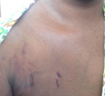 Keur Mbaye Fall : Une dame retrouvée morte, ligotée à un fauteuil