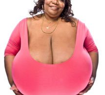 Insolite : Ses deux seins pèsent 50 kilos, la femme à la plus forte poitrine naturelle au Monde