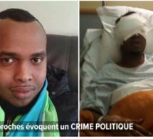 Un homme se fait "arracher" les yeux en pleine rue
