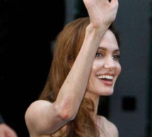 Angoissée par le divorce, Angelina Jolie est descendue à 34 kg