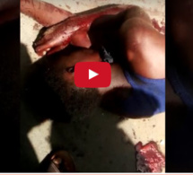 Vidéo+Photos: Un garçon sauvagement poignardé à mort au rond point case ba Parcelles assainies (attention âme sensible)
