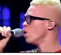 Regardez comment ce "Albinos" chante "Tadjabonne"?
