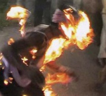 Niakhar : Largué par sa copine étudiante, il s’immole par le feu