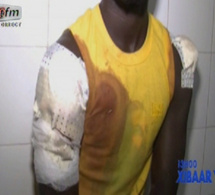 Chambre criminelle de Dakar: SA JAMBE AMPUTÉE, SA TÊTE FRACASSÉE… Comment le fils du présidentde l’Association des maures du Sénégal a été cruellement agressé