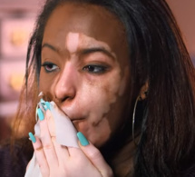 Pendant 7 ans, elle s’est cachée derrière le maquillage – mais aujourd’hui, elle est enfin prête à dévoiler qui elle est vraiment