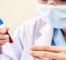 Science: Un nouveau test sanguin pourrait révéler combien de temps il vous reste à vivre
