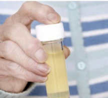 Infection urinaire: causes et symptômes