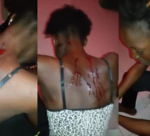 Touba : La femme Ndeye Coumba, battue porte plainte contre le mari