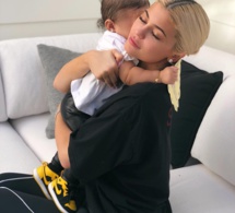 Kylie Jenner accro aux injections des lèvres ? Son médecin lève le voile sur sa chirurgie esthétique