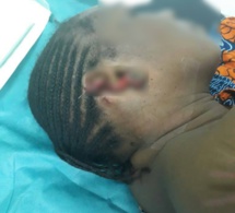 SCÈNE DE JALOUSIE: Avec l’aide de sa fille, la aawo arrache une oreille à sa coépouse… âme sensible