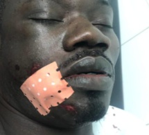 Urgent : Guin Thieuss sauvagement agressé…