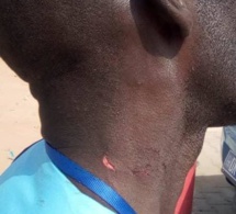 Violenté par un garde rapproché du Président à l'inauguration de la mosquée de Guédiawaye, Pape Doudou Diallo menace de porter plainte