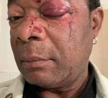 Le père de Dadju et Maître Gims sauvagement agressé dans les rues de Paris