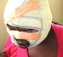 Horreur à Tivaouane : Khady Ndiaye verse de l’huile chaude sur sa co-épouse et sa fille