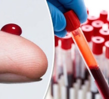 INCROYABLE ! Un nouveau test sanguin créé pour prédire la mort