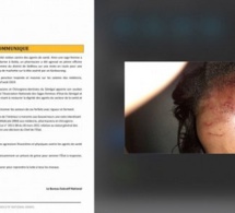Sédhiou: Une sage-femme agressée par deux Kankourang
