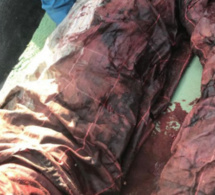 NDIOUROUL : Un adolescent tailladé à coups de machette par des bergers