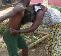 Coups et blessures volontaires : Elle s’agrippe aux testicules de son ex-mari et perd huit dents