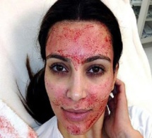 Kim Kardashian intente un procès contre un médecin esthétique