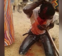 EN COMPAGNIE DE SES ENFANTS :Une femme attaquée par cinq agresseurs a Mermoz.