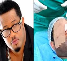 L’acteur nigérian Mike Ezuruonye a subi une chirurgie des yeux (photo)