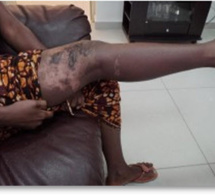 Louga: Bagarre entre coépouses, Rouguiyatou Sow casse le bras d’Absa Sow