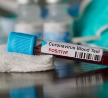Test coronavirus : Le Senegal bat le record de rapidité