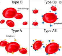 Des chercheurs affirment avoir établi un lien entre un groupe sanguin et le risque d’infection au coronavirus
