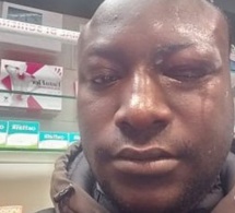 Italie : Le Sénégalais déjoue un cambriolage, perd un oeil et gagne des félicitations
