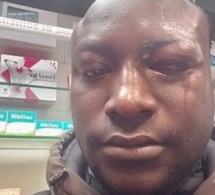Italie : Le Sénégalais déjoue un cambriolage, perd un oeil et gagne des félicitations