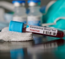 Coronavirus : La région de Louga enregistre son premier cas