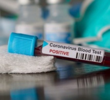 18 cas de coronavirus à Louga : Le préfet annonce une batterie de mesures